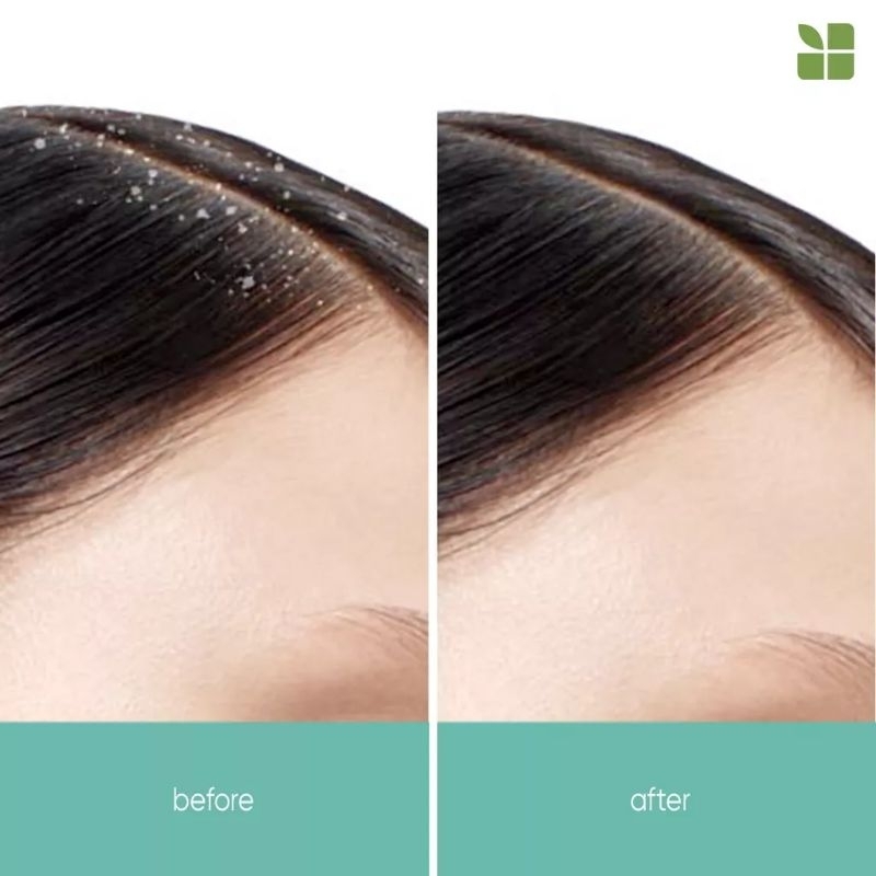 MATRIX Biolage SCALP REFRESHHER