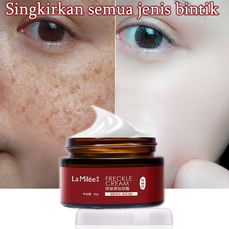 Cream pemutih wajah Krim bintik pemutih 30G Singkirkan melasma, bintik-bintik, bintik matahari, bintik-bintik penuaan, bintik-bintik kehamilan, bintik-bintik gelap Memperbaiki dasar kulit, memutihkan, melembabkan, mencerahkan kulit