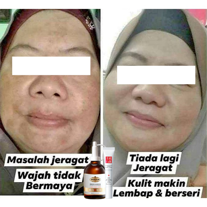 Pemutih wajah Serum pemutih wajah Night whitening salep flek hitam Penghilang flek hitam Salep Flek Hitam Melasma 100ML Secara efektif mengatasi flek hitam dan kulit hitam/Memutihkan kulit，memperbaiki kulit