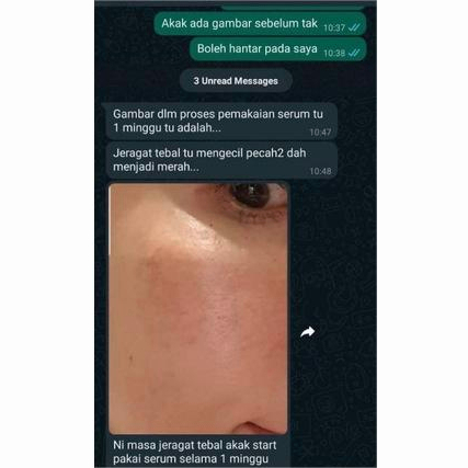 Serum wajah Serum wajah anti Memutihkan wajah 30ML Astaxanthin,Niacinamide,Kolagen Mencegah melawan keriput,Pengencangan anti-penuaan,Pemutihan penghapusan flek,Meringankan garis-garis halus,Mengecilkan pori-pori,Memperbaiki kusam mencerahkan warna kulit