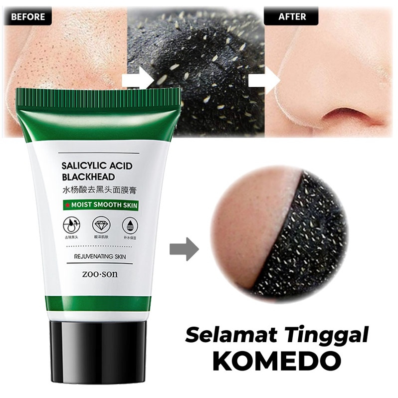 [COD] ZOO SON Salicylic Acid Blackhead Mask Masker Arang Hitam Pengangkat Komedo