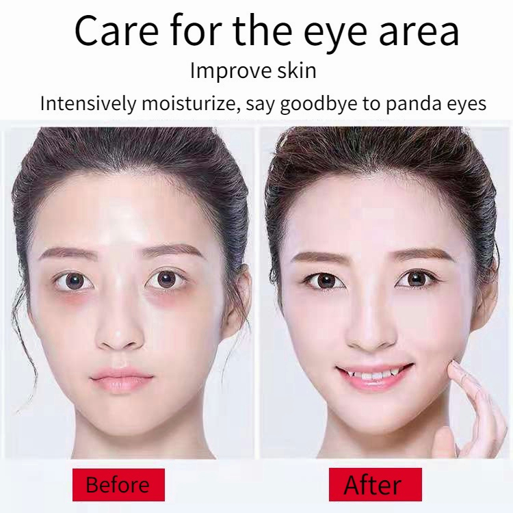 Krim mata treatment mata Eye cream Kecantikan mata Krim mata panda 20g Activating Menghilangkan lingkaran mata hitam Krim