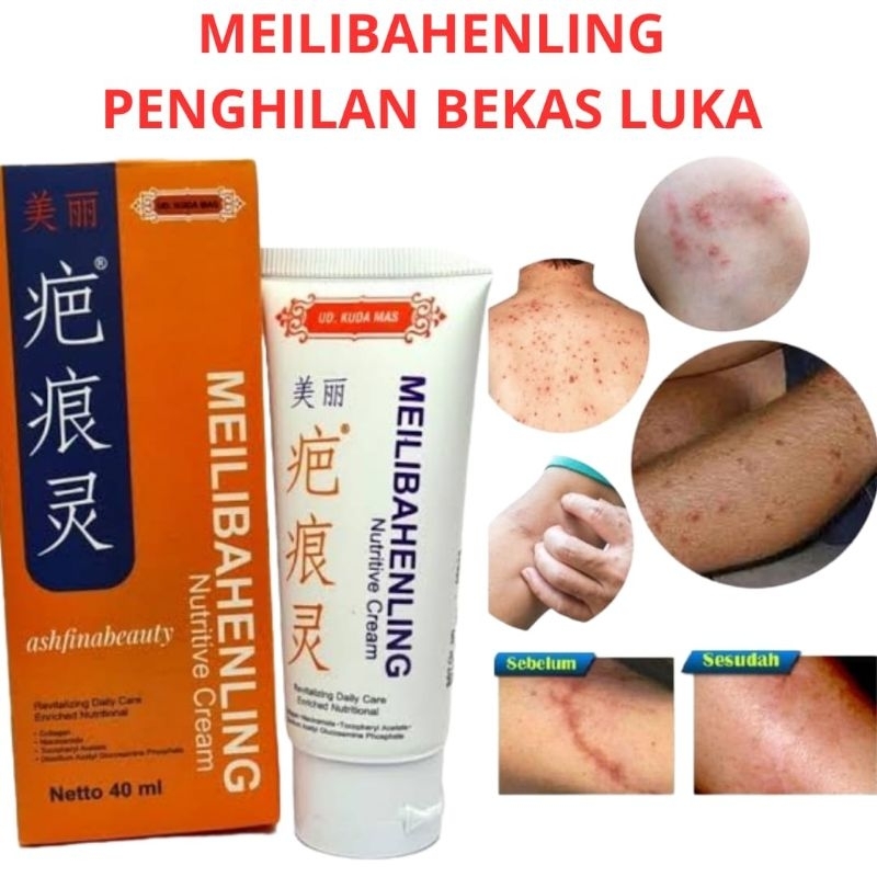 Meilibahenling Nutritive Original 100% Obat Cream Penghilang Bekas Luka Koreng Bopeng Jerawat