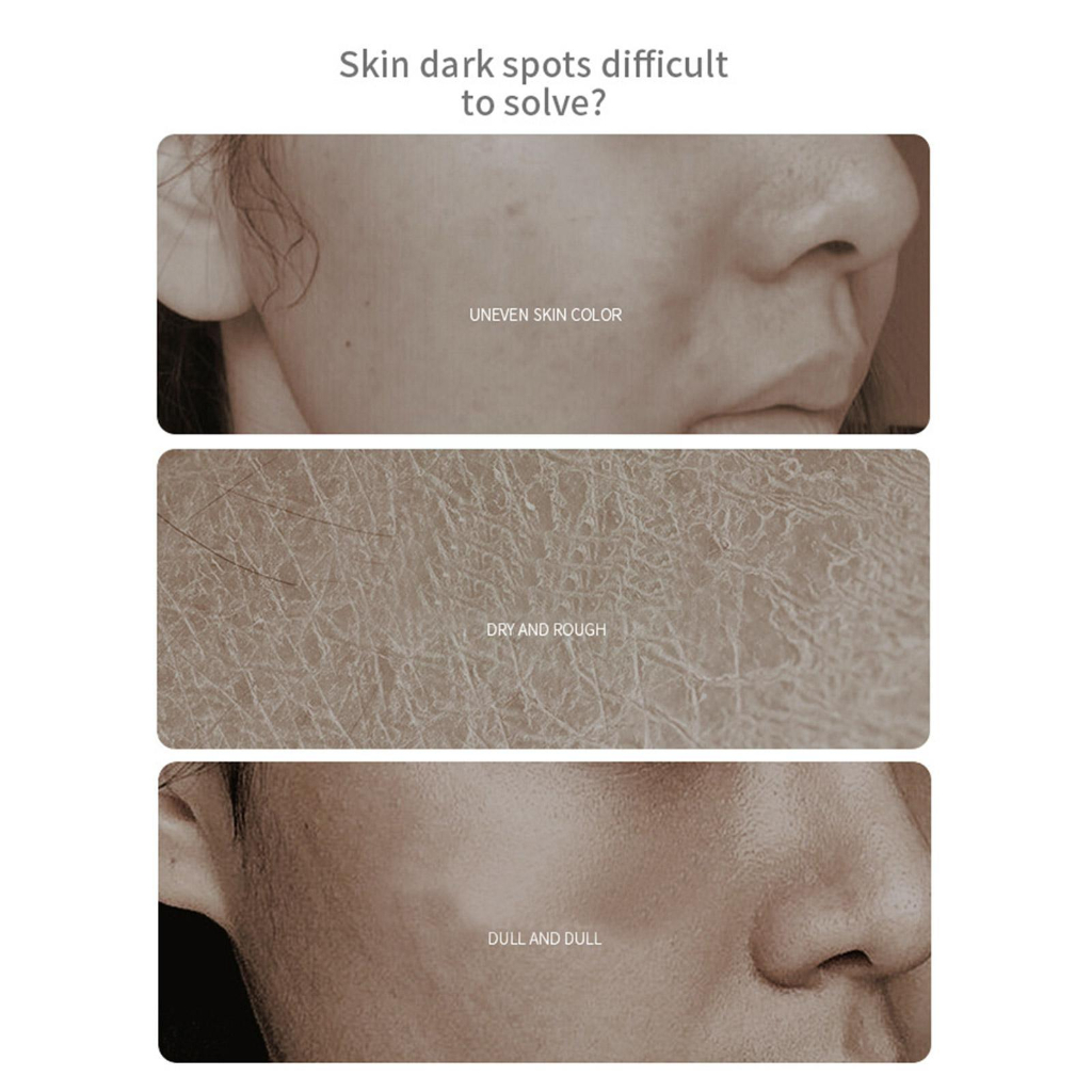 30ml Orchid Essence Oil Whitening And Freckle Removal Time Condensation Oil Moisturiz Orchid Hydrating Oil Dissolving Essence