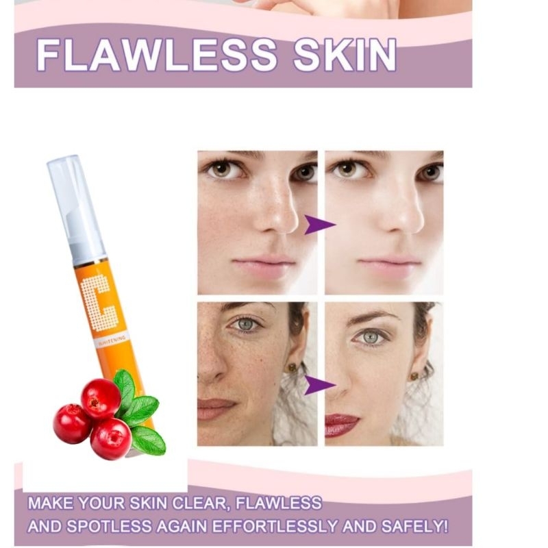 Pena penghilang melasma / Whitening Pale spot cream Bpom