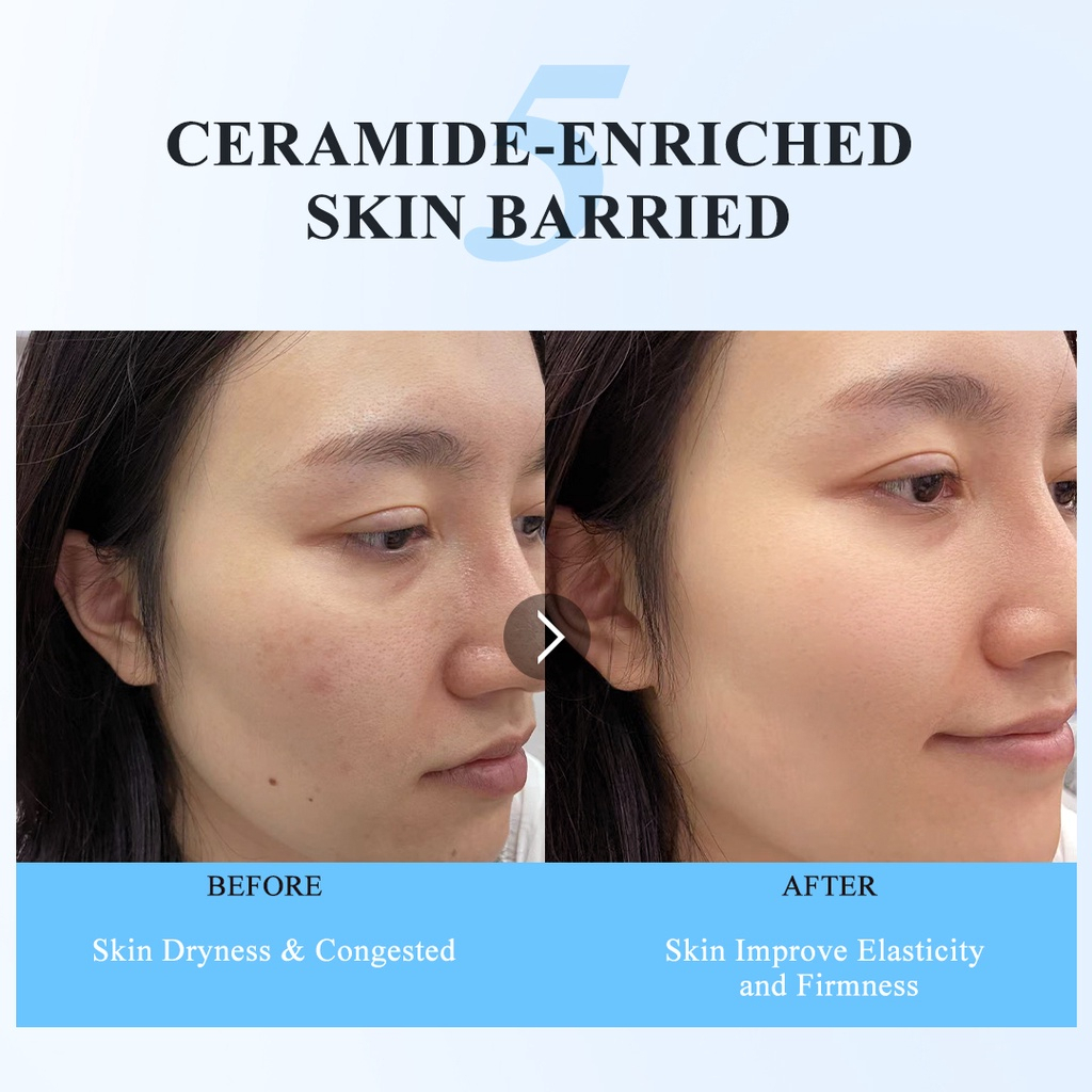 ✨ AKU MURAH ✨ Premiere Beaute Barrier Care Series Ceramide Nourishing Serum 30ML
