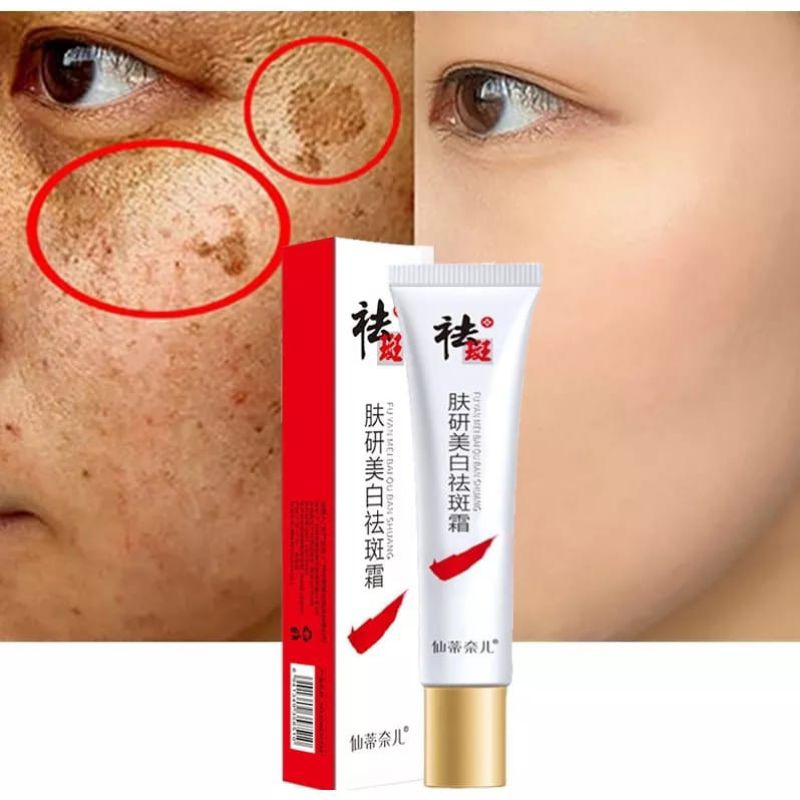 ❤LAMONNA❤ CYNDINAL CREAM PENGHILANG FLEK Jerawat dan Noda Hitam Komedo Whitening Freckle Cream Dark 