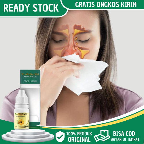 Obat Sinusitis, Hidung Sinusitis Menahun, Hidung Bau Busuk, Hidung Tersumbat, Konka Hidung, Hidung T