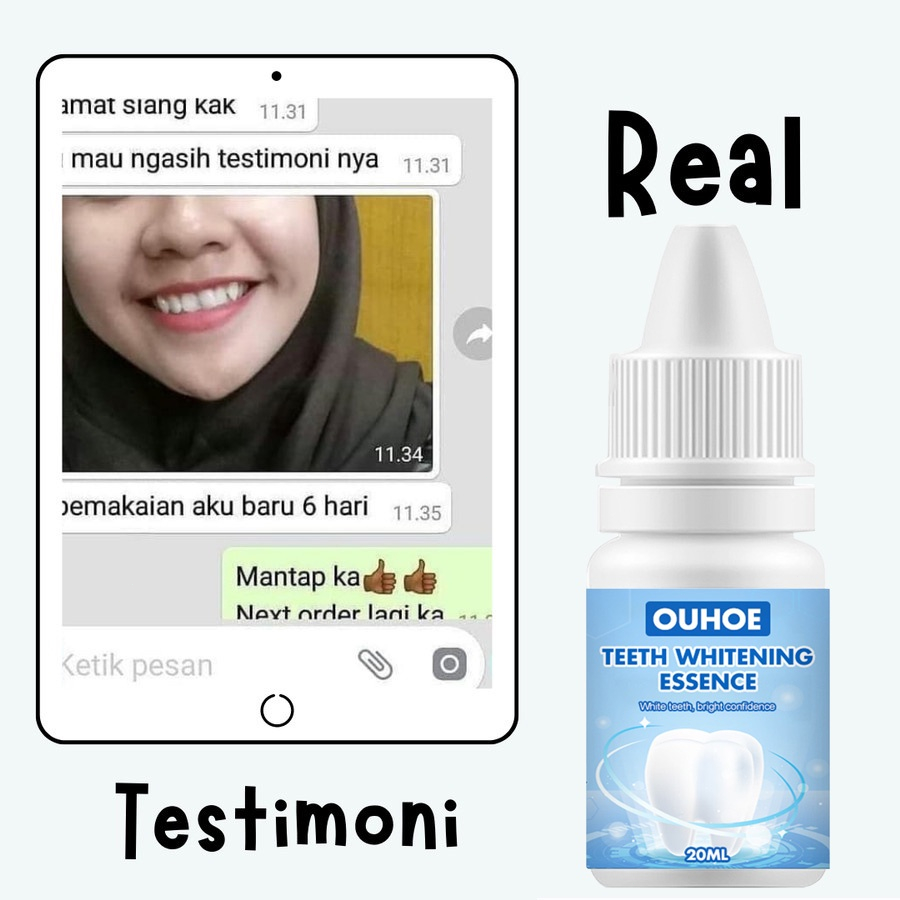 Perawatan Mulut Toothpaste Pemutih gigi Pasta gig Teeth whitening Cairan gigi putih 30ml Menghilangkan noda teh Gigi kuning Plak Napas jernih melindungi gusi Jaga kebersihan mulut