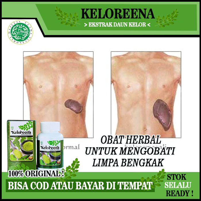 Obat Penyakit Limpa Bengkak, Obat Limpa Bengkak Herbal, Obat Pencegah Limpa Bengkak, Obat Atasi Pemb