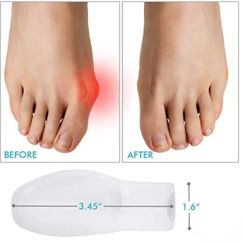 INSOLE SEPATU SILICON ANTI BUNION TOE INSOLE JARI INSOLE SILICON