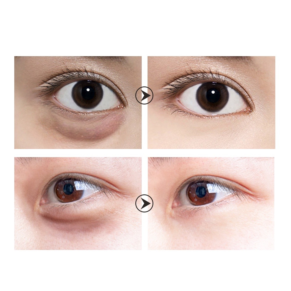 [Ori100%]ALLPHV Black Pearl Hydra Gel Eye Patches Mask Mata Anti-Aging Melembabkan Anti-kerut Hapus Kantung Mata Perawatan