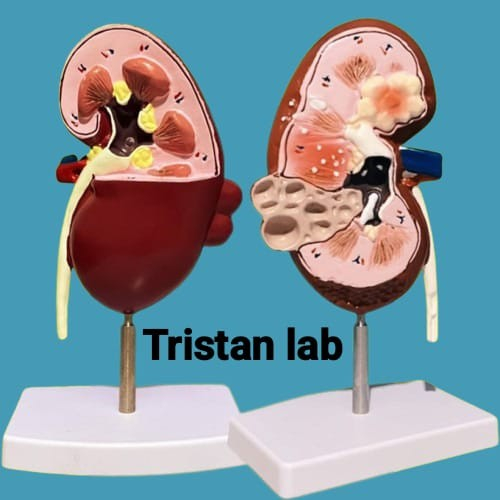 Kerangka Ginjal Manusia Alat Peraga / Kerangka Ginjal Manusia