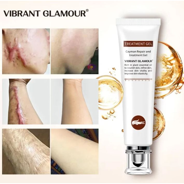 Vibrant Glamour Cayman Repair and Treatment Gel Penghilang Bekas Luka 20gr