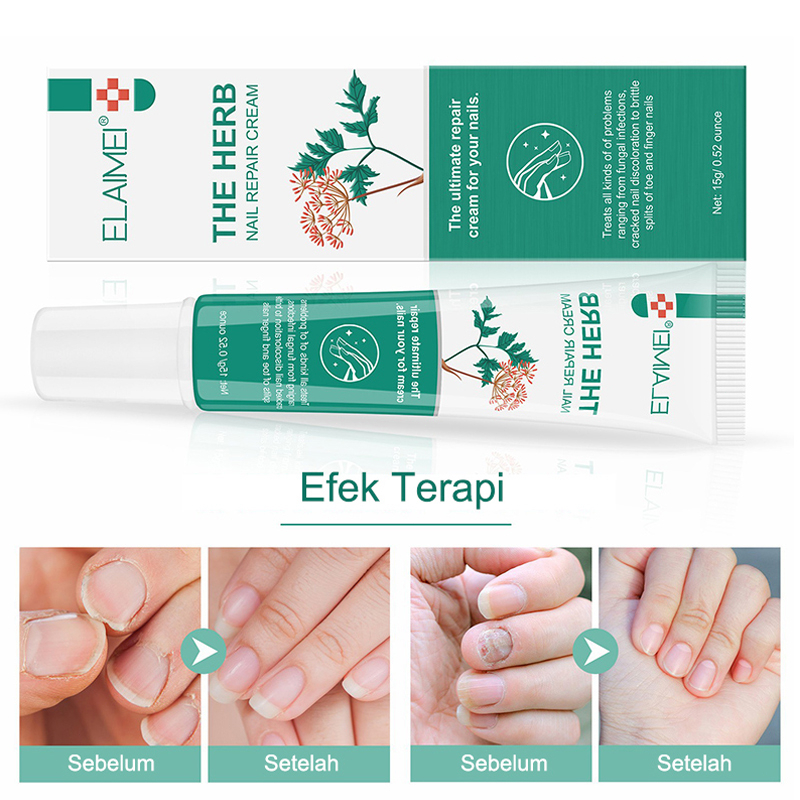 Perawatan kuku Krim Nail repair cream OnikomikosisParonychia Infeksi Kuku 15g  Anti Jamur Pengobatan Soften the cuticle Quick fix