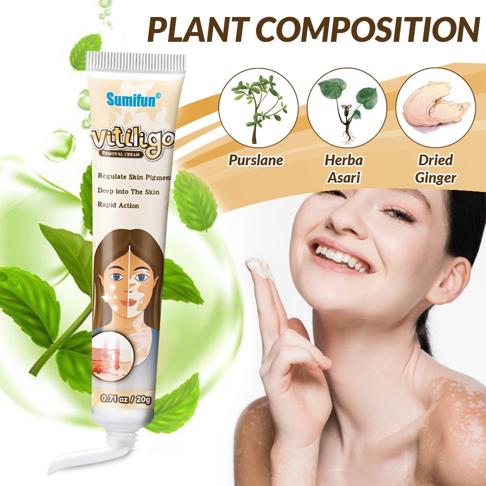 Vitiligo salep vitiligo obat vitiligo Vitiligo treatment cream vitiligo cream Vitiligo/bintik keringat/chloasma/bintik hitam tidak ada efek samping BPOM 20g