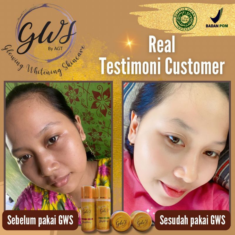 GWS GLOWING WHITENING SKINCARE
