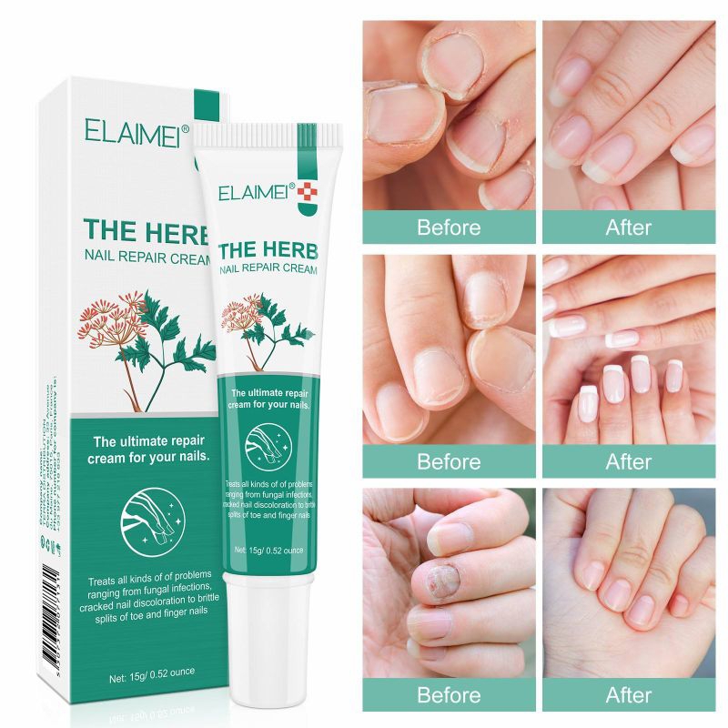Elaimei The Herb Nail Repair Cream Perbaikan Kuku Rusak, Mengobati Jamur Kuku
