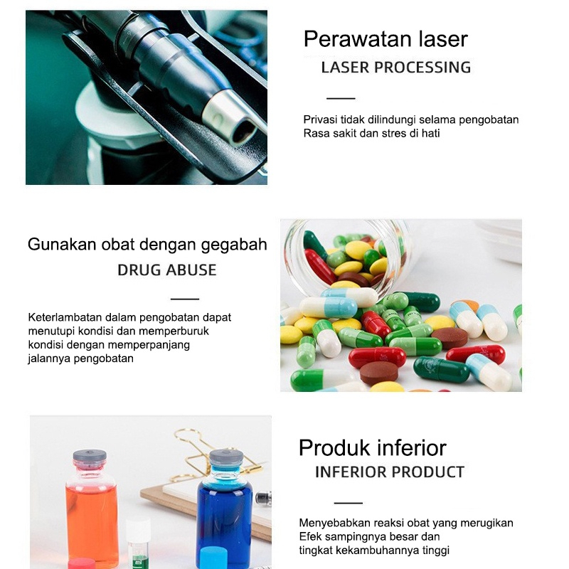 Krim kutil obat penghilang kutil penghilang kutil 20g skin tag remover Menghilangkan kutil, tahi lalat, berbagai skin tag di berbagai bagian tubuh