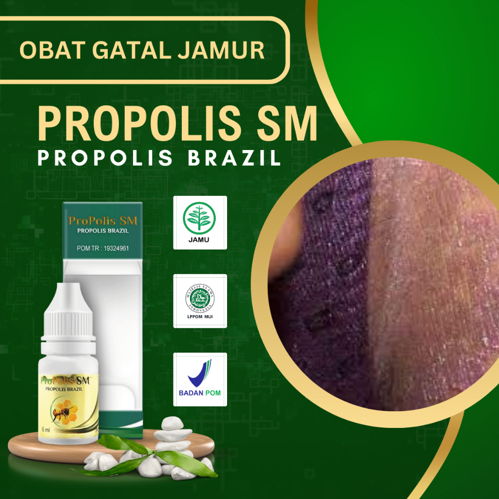 Salep Gatal Selangkangan, Obat Selangkangan Gatal Dan Jamur, Obat Selangkangan Hitam,, Obat Selangka