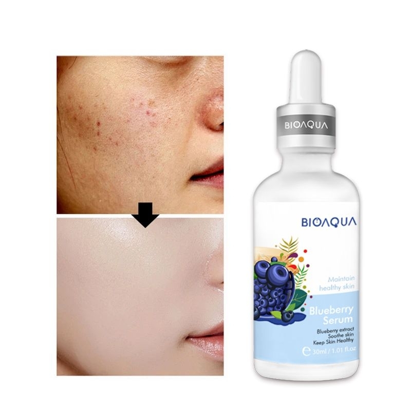 Bioaqua Serum Blueberry Extract BPOM Mencerahkan Melembabkan Menutrisi Mengecilkan Pori-Pori Menghilangkan Kerutan &amp; Flek Hitam / Bioaqua Blueberry Extract Serum Wajah Glowing / Blueberry Serum Wajah Bioaqua / Serum Pelembab Wajah / Serum Pencerah Wajah