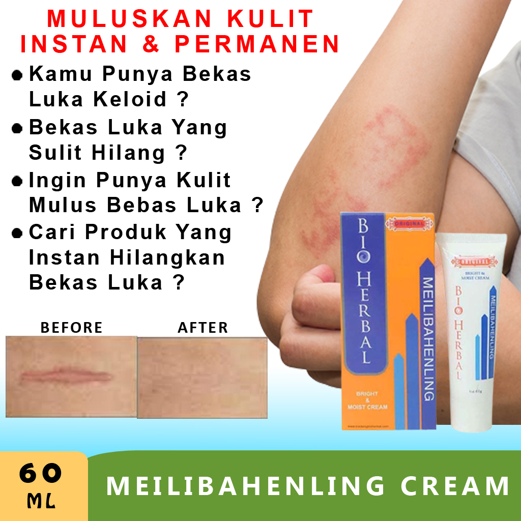 Salep Penghilang Bekas Luka Hitam Jerawat Koreng dan Keloid Cream Krim Penghilang Bekas Luka