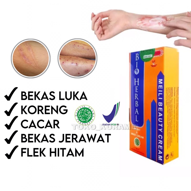 ORIGINAL Meilibahenling Cream Penghilang Bekas Luka Hitam Bopeng Koreng /Jerawat Permanen