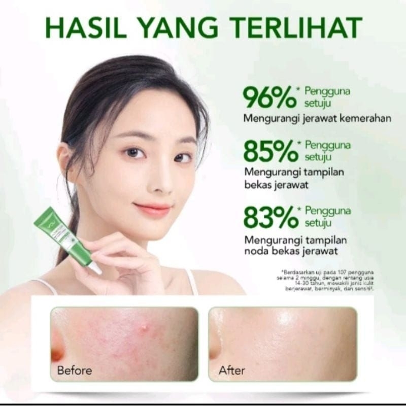 ☘️Yuri Kosmetik☘️ You Acne Plus Triple Action Spot Care 15gram