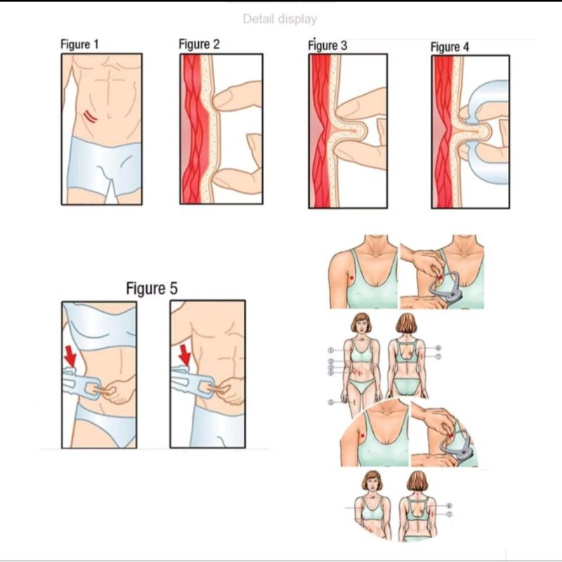 Alat Ukur Lemak Tubuh - Body Fat Caliper