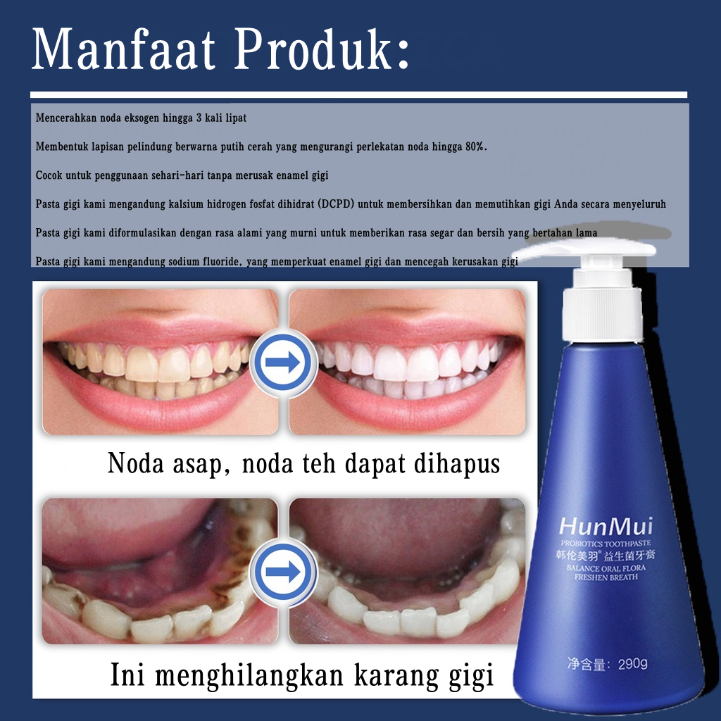 Pasta Gigi Pemutih Permanen Penghilang Karang Gigi dan Gigi Kuning 290g Press-Type Berkapasitas Besar Pasta Gigi Probiotik Menyeimbangkan Bakteri Mulut Teeth Whitening Toothpaste