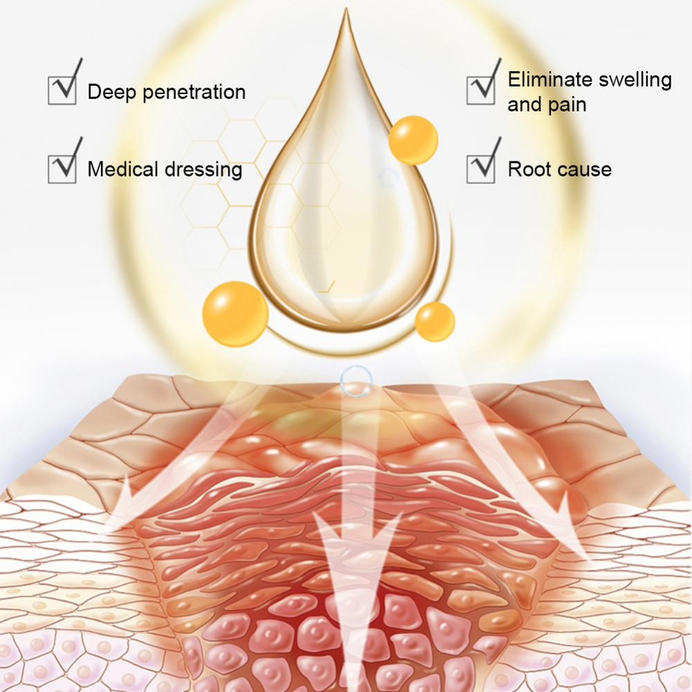 SUAI Ai Armor Guards Remove Ingrown Nail Essentl Oil Nail Groove Hair Paronychia Onychomycosis Tools