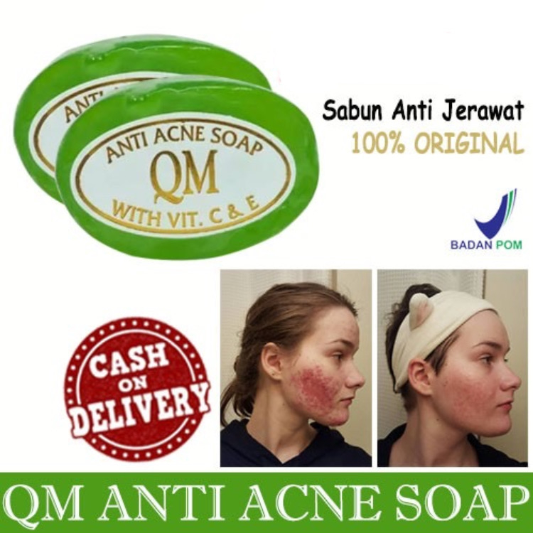 {ORIGINAL}QM FACIAL SOAP FOR ACNE SKIN ORIGINAL BPOM - SABUN QM ANTI ACNE