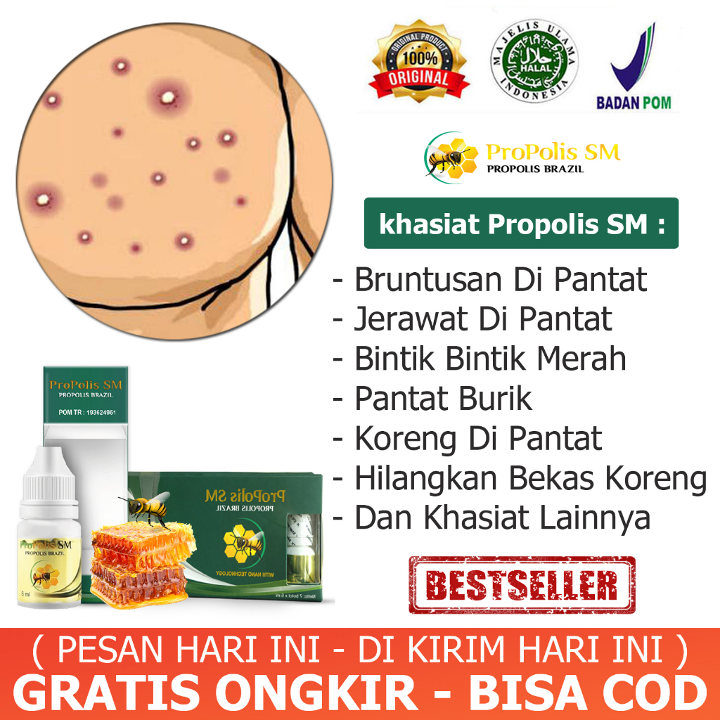 Obat Bruntusan Di Pantat, Jerawat Bintik Merah Di Pantat, Penghilang Bekas Koreng Di Pantat - Jamu O