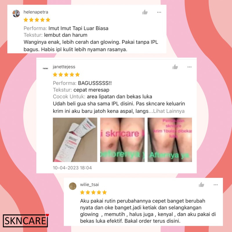 SKNCARE Underarm Cream Krim Pencerah Pemutih &amp; Penenang Ketiak Selangkangan Bokong dan Lipatan Kulit. Krim setelah IPL - Krim Penenang Setelah IPL - After Care IPL Treatment - Krim Pemutih Selangkangan Bokong Ketiak Sikut Lutut Tangan Kaki Leher.Deodoran