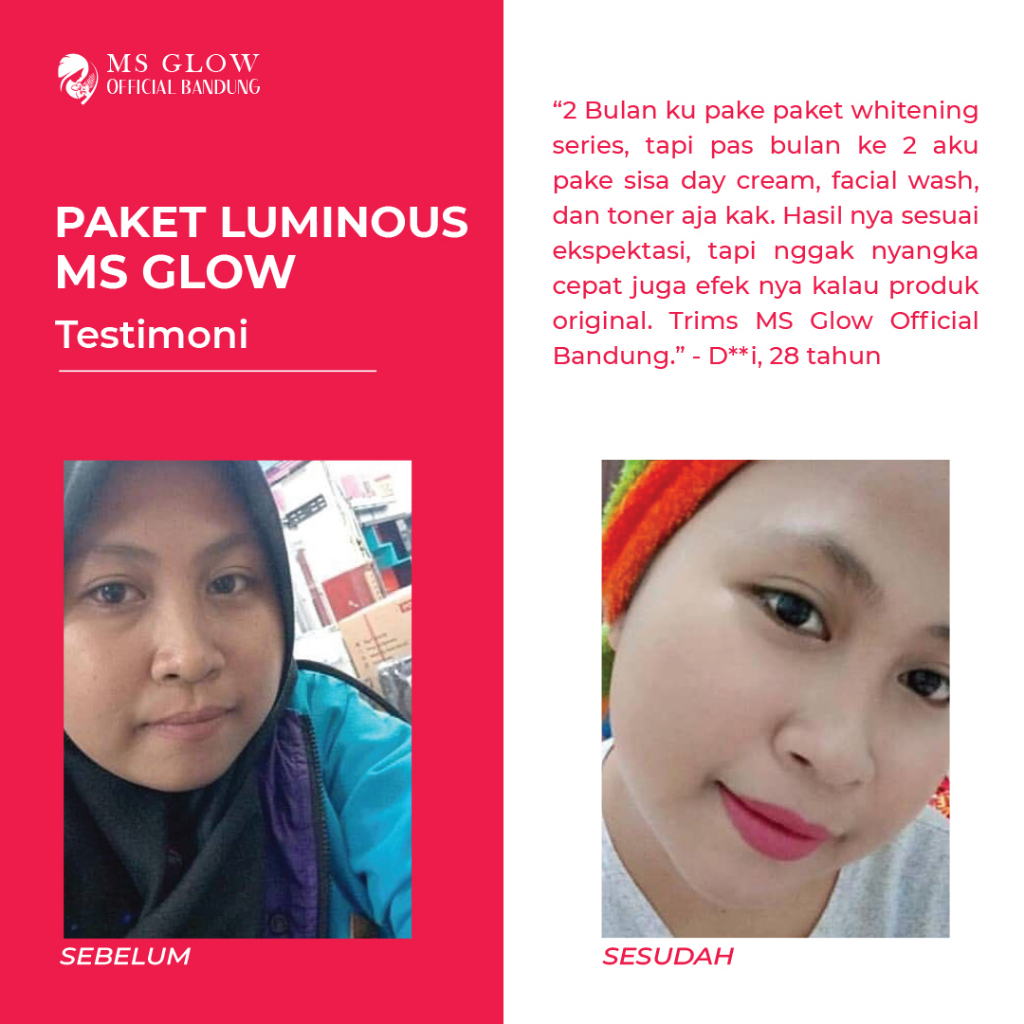 Ms Glow Original Paket Luminous Termurah Berkualitas - By Msglowofficialbandung