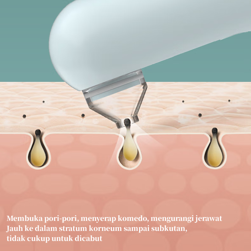 INFACE Alat Penyedot Komedo Visual Jerawat 2In1 Blackhead Removerhisap Komedo Visual Alat Pembersih Komedo  4 Probes Alat Perawatan Wajah CF05E