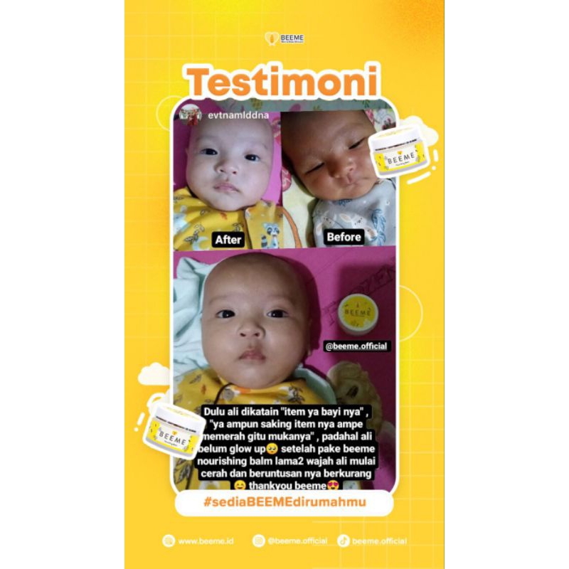 BEEME NOURISING BALM ORIGINAL || PELEMBAB SERBAGUNA