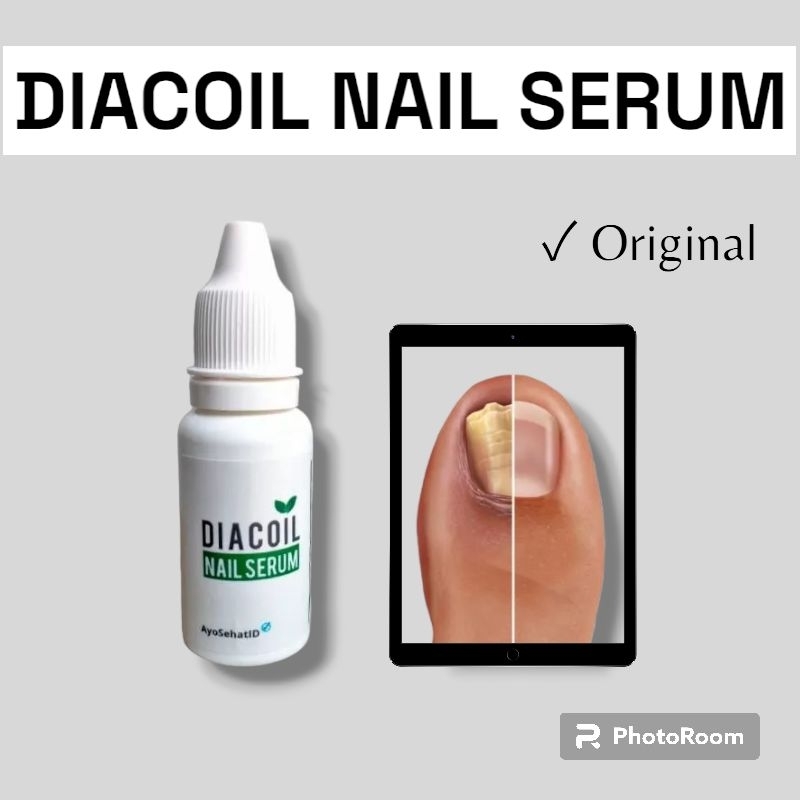 DIACOIL NAIL SERUM OBAT TETES KUKU CANTENGAN DAN JAMUR KUKU