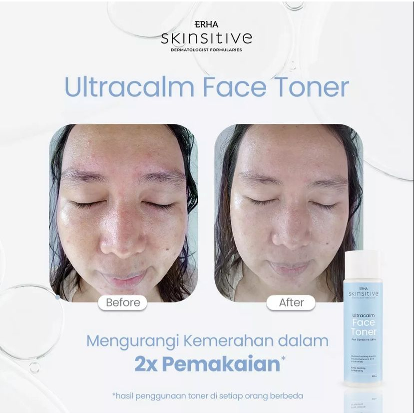 ERHA SKINSITIVE ULTRACALM FACE TONER 100ML - TONER KULIT WAJAH SENSITIF