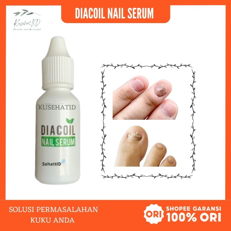 [100% ASLI] DIACOIL NAIL SERUM OBAT JAMUR KUKU CANTENGAN JEMPOL KAKI DAN KUKU RUSAK PALING AMPUH 100
