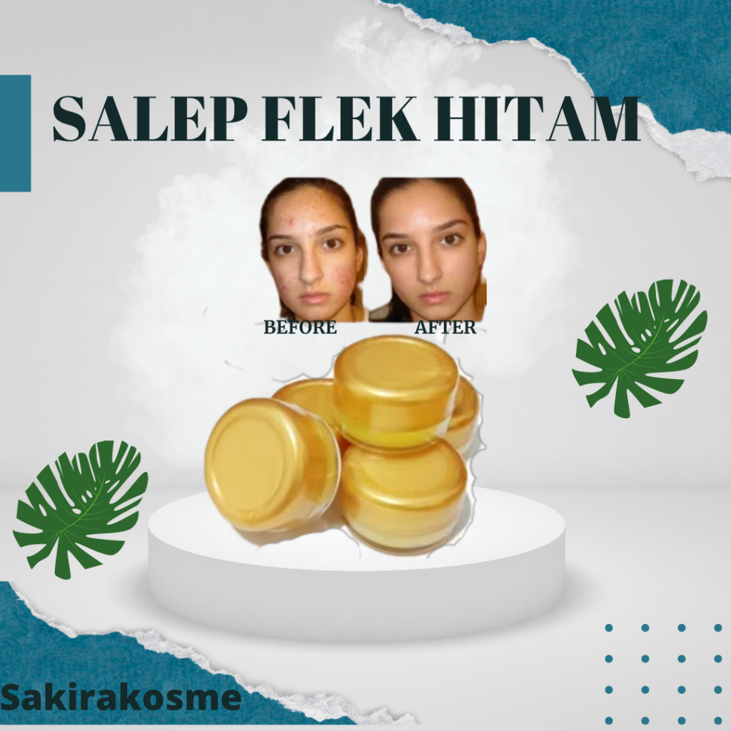 SALEP FLEK HITAM - SALEP PENGHILANG FLEK -SALEP FLEK -SALEP AMPUH MEMUDARKAN FLEK HITAM