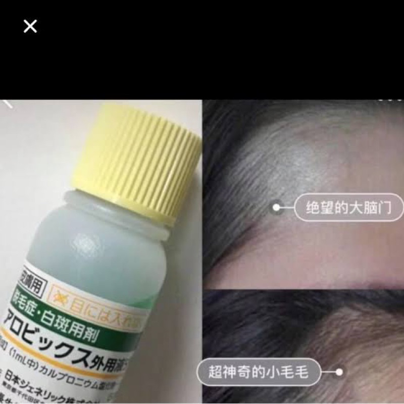 SERUM PENUMBUH RAMBUT DAN ANTI RONTOK JEPANG MENUMBUHKAN JUGA MELEBATKAN EFEKTIF DAN PASTI BERHASIL SERUM ALOPECIA SERUM SEBORRHEA