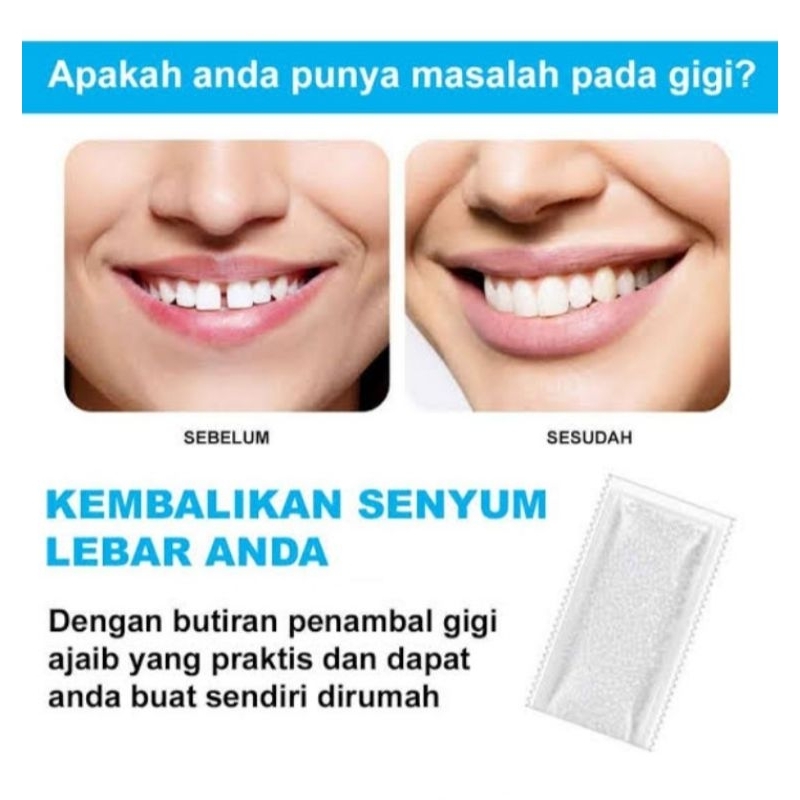 Temptooth penambal gigi ompong butir