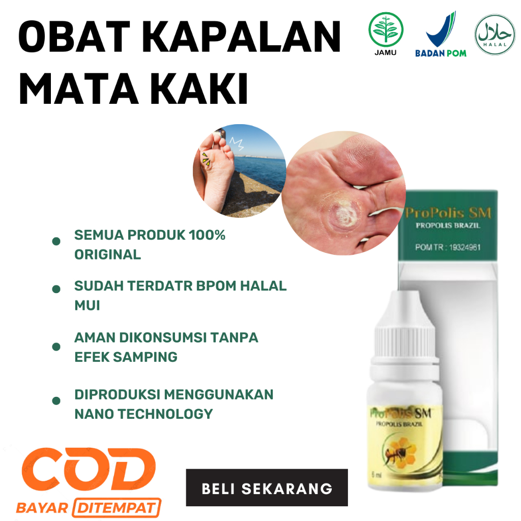 Propolis SM - Obat Kapalan Kaki, Obat Kapalan Mata Kaki, Obat Kapalan kaki Tebal, Obat Kapalan Telap