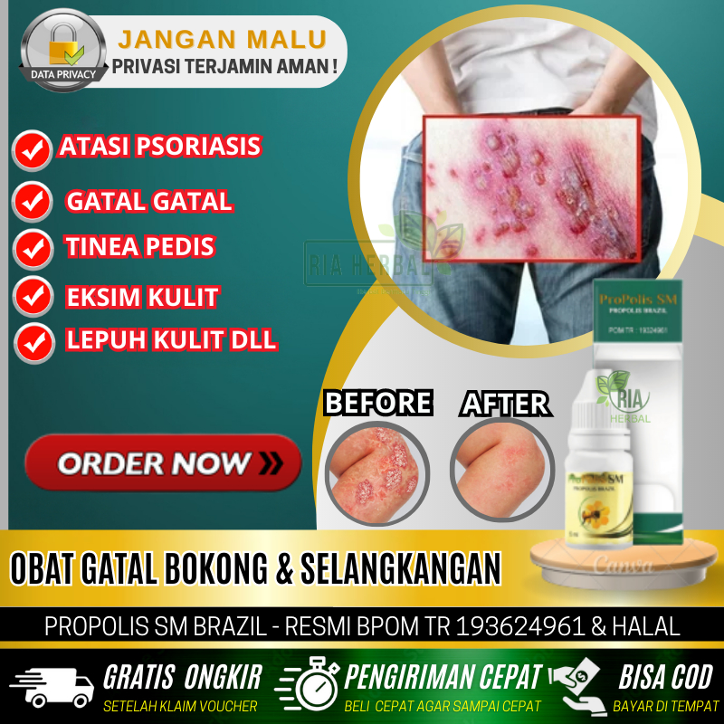 Salep Kurap Salep Gatal Selangkangan, Penghilang Gatal Bruntus, Gatal Pantat Bokong, Gatal Salep Kut