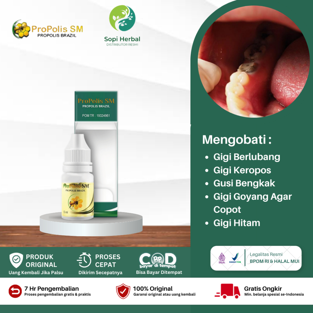 Obat Gigi Sering Nyut Nyutan, Obat Gigi Rusak, Obat Sakit Gigi Berlubang, Obat Gigi Keropos, Obat Gi