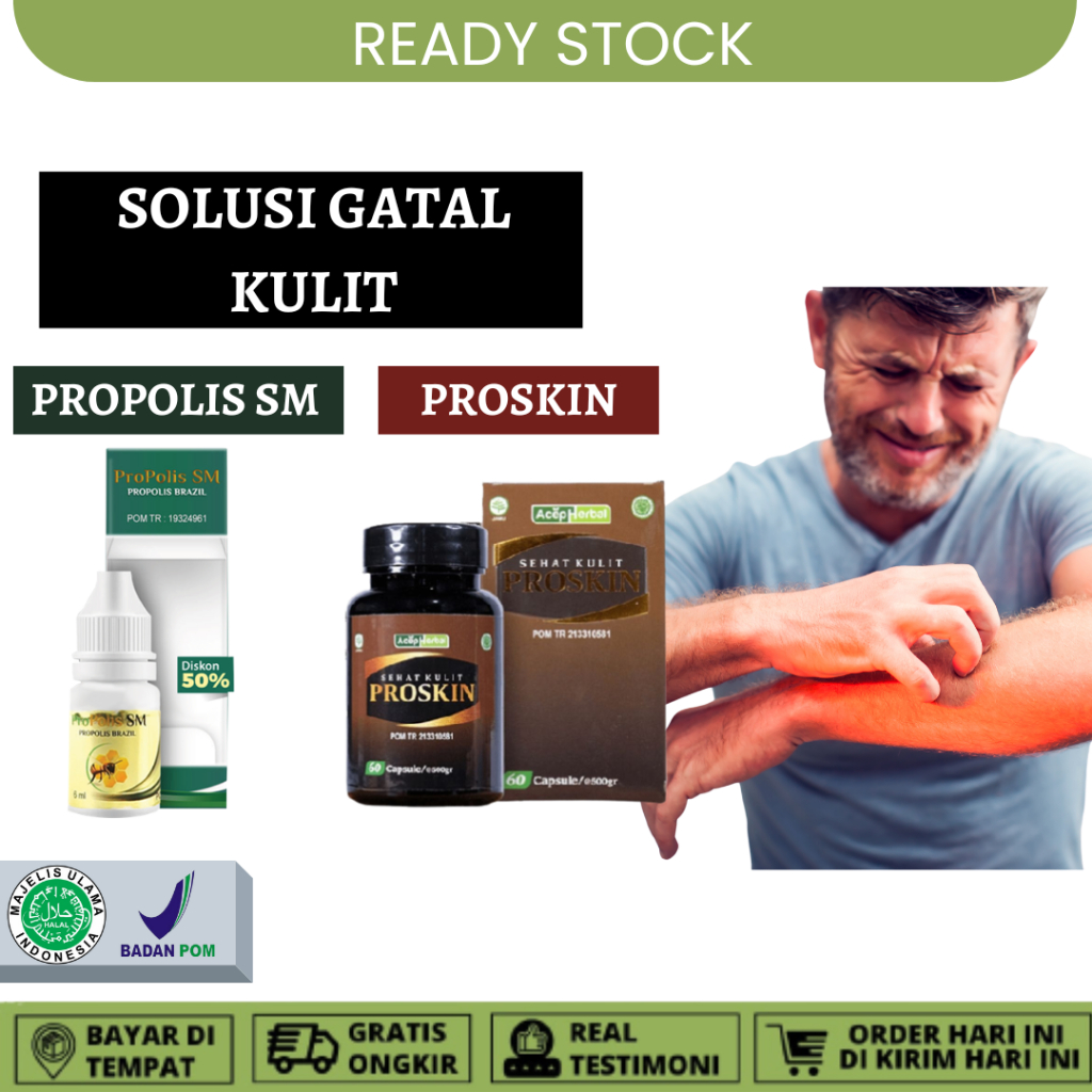 Obat Kurap di Selangkangan Obat Gatal Kulit Jamur di Selangkangan Panu Kurap Hapuran Kadas Eksim Kut