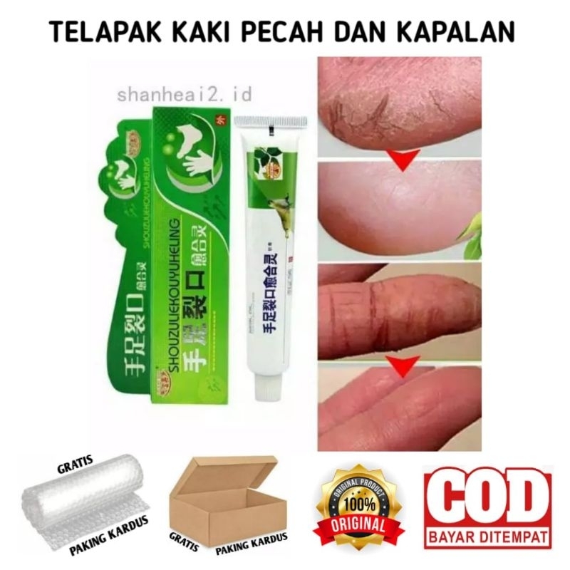 OBAT TELAPAK KAKI PECAH- PECAH KAPALAN DAN KUTU AIR