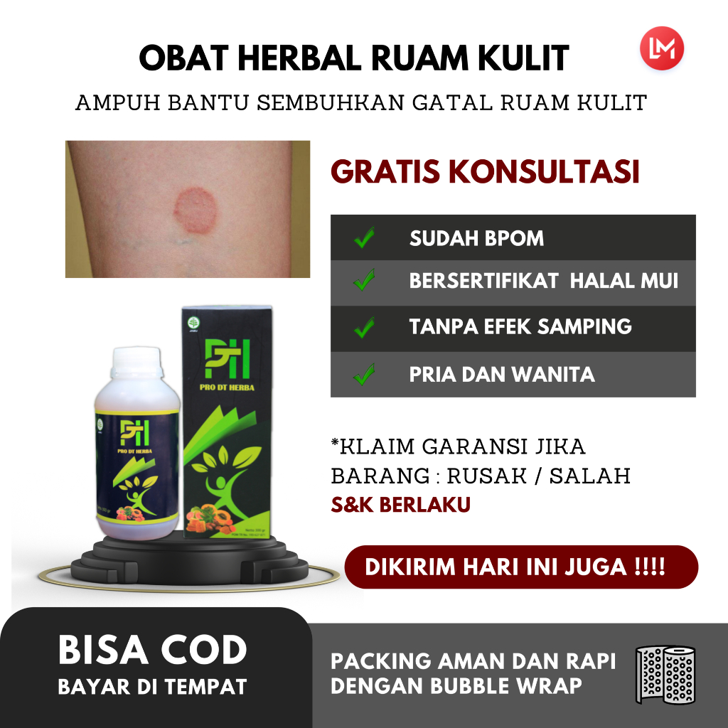 Obat Ruam Kulit Dewasa, Obat Ruam Kulit Anak, Obat Gatal Resep Dokter, Obat Gatal Buatan Cina, Obat 