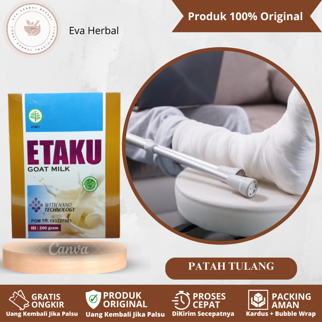 

Susu Kalsium Untuk Patah Tulang, Susu Patah Tulang Akibat Jatuh Kecelakaaan, Susu Tulang Retak, Remuk, Keropos, Susu Penambah Kalsium, Susu Sembuhkan Patah Tulang Dengan Walatra Etaku Goat Milk
